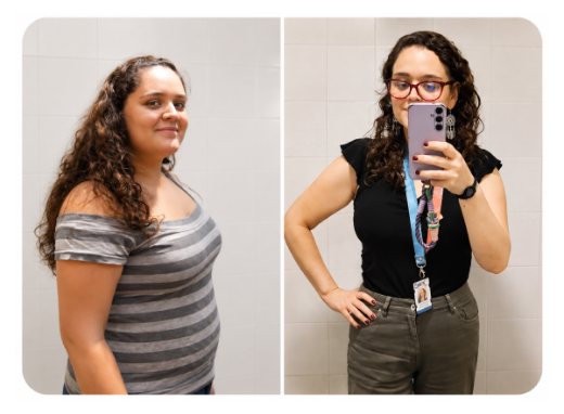 Carolina, antes y después de su cirugía bariátrica
